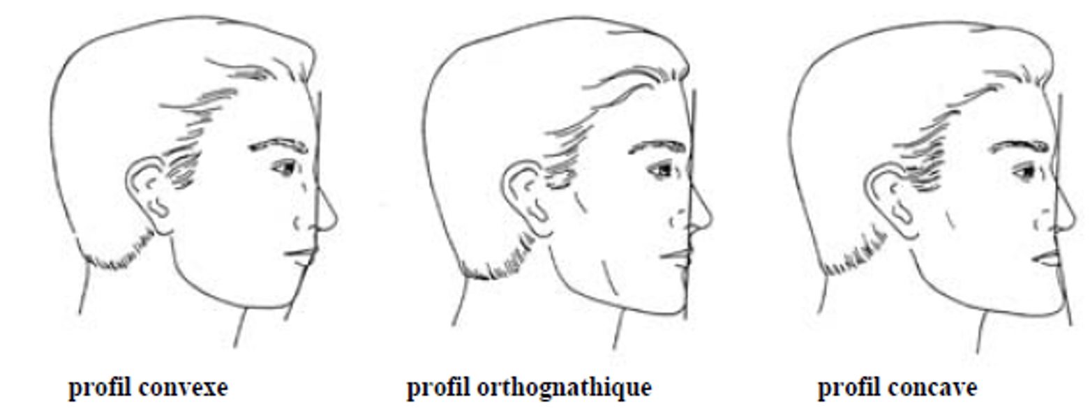 Наклоненный лоб. Виды профилей лица. Линия профиля лица. Выпуклый профиль лица. Выпуклый Тип профиля лица.