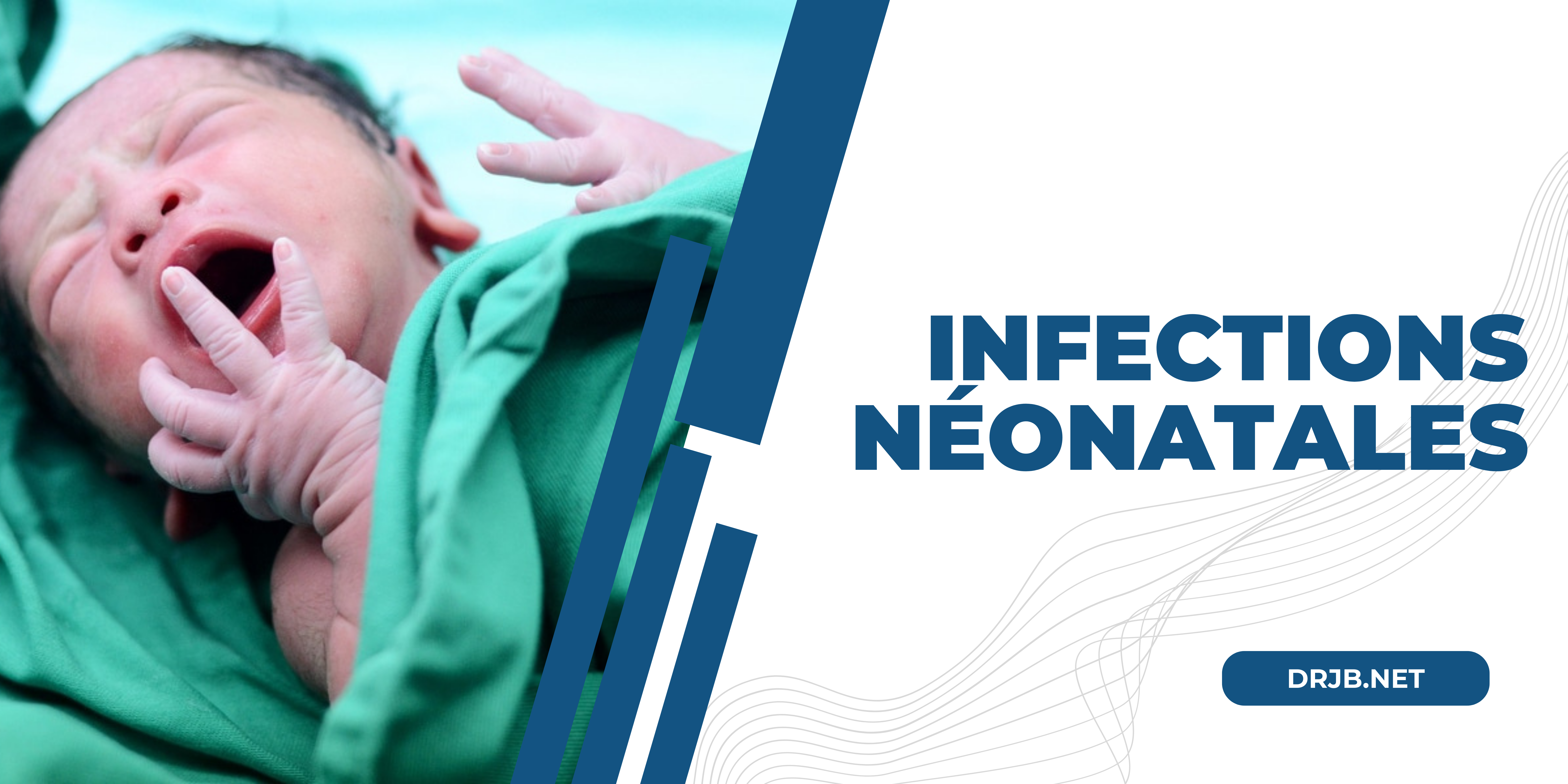 Infections néonatales DRJB